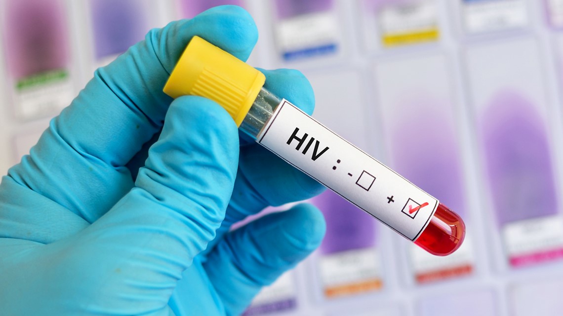 New HIV strain discovered; first in 19 years