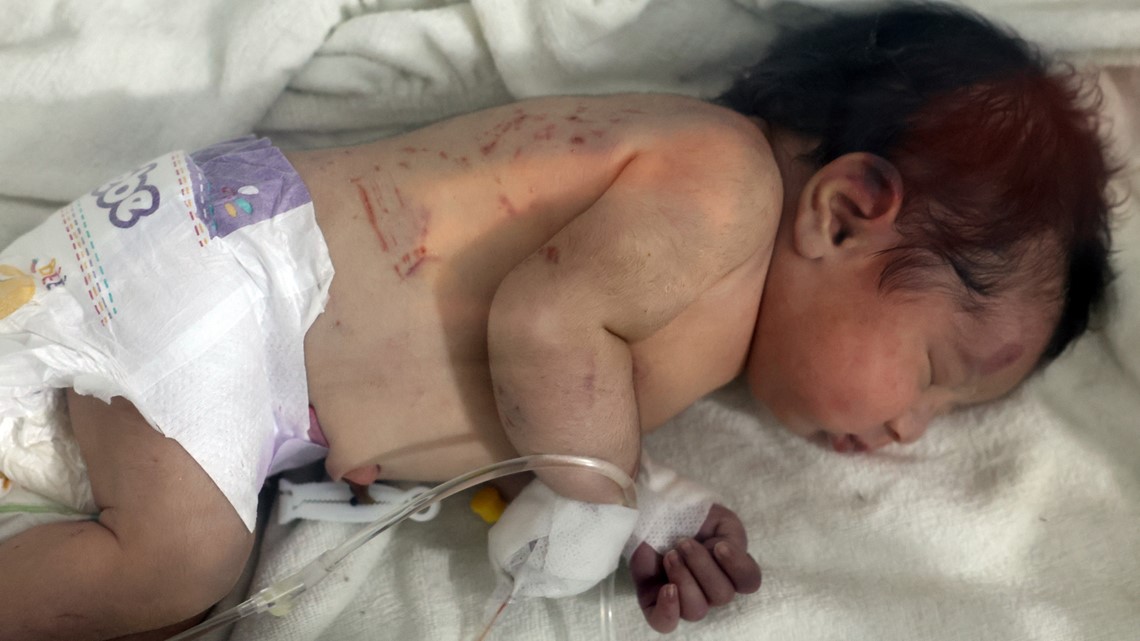 Newborn rescued from earthquake rubble in Syria - Vimarsana News