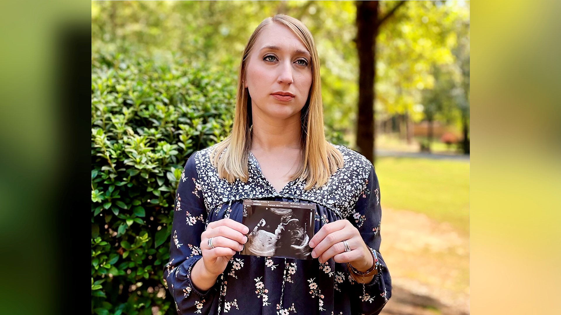 Two women from Georgia and Alabama who contracted COVID-19 during their pregnancies are urging other pregnant women to get vaccinated.