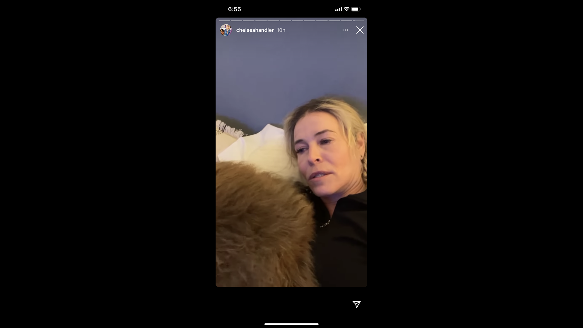 Chelsea Handler Suffers a Torn Meniscus and Broken Toes After Skiing