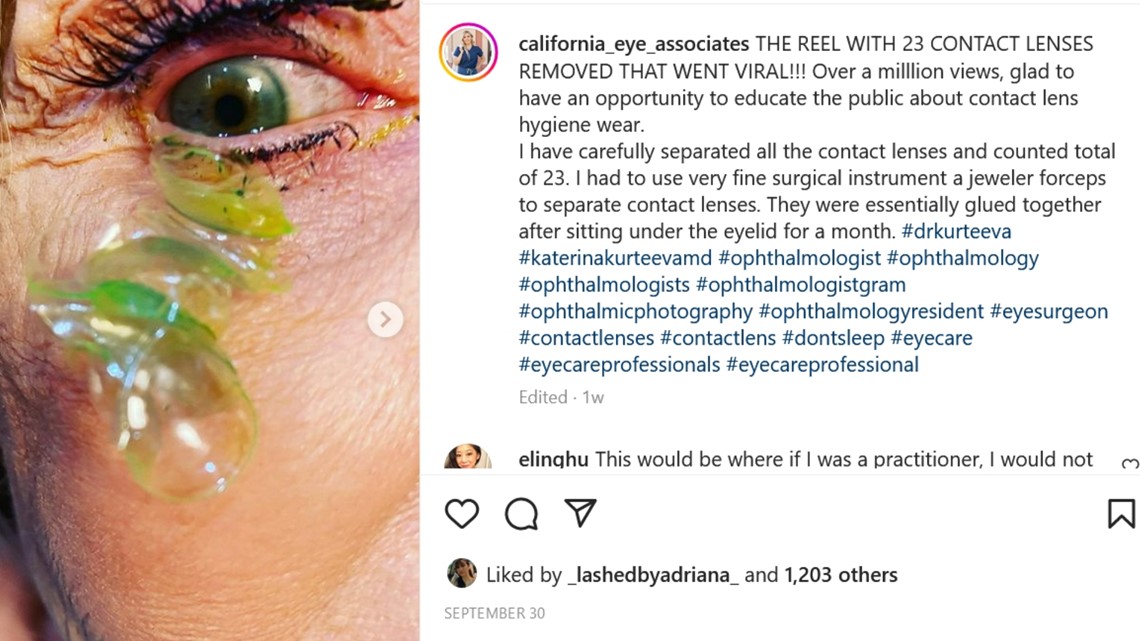 Reacts Don't sleep with contacts in your eyes