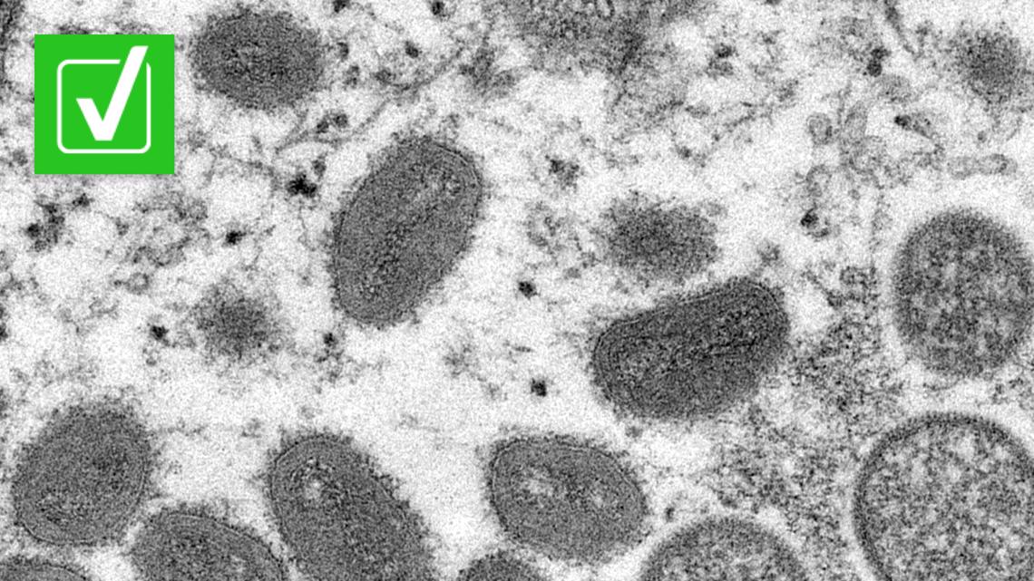 No, there haven’t been any monkeypox deaths reported yet in the U.S.