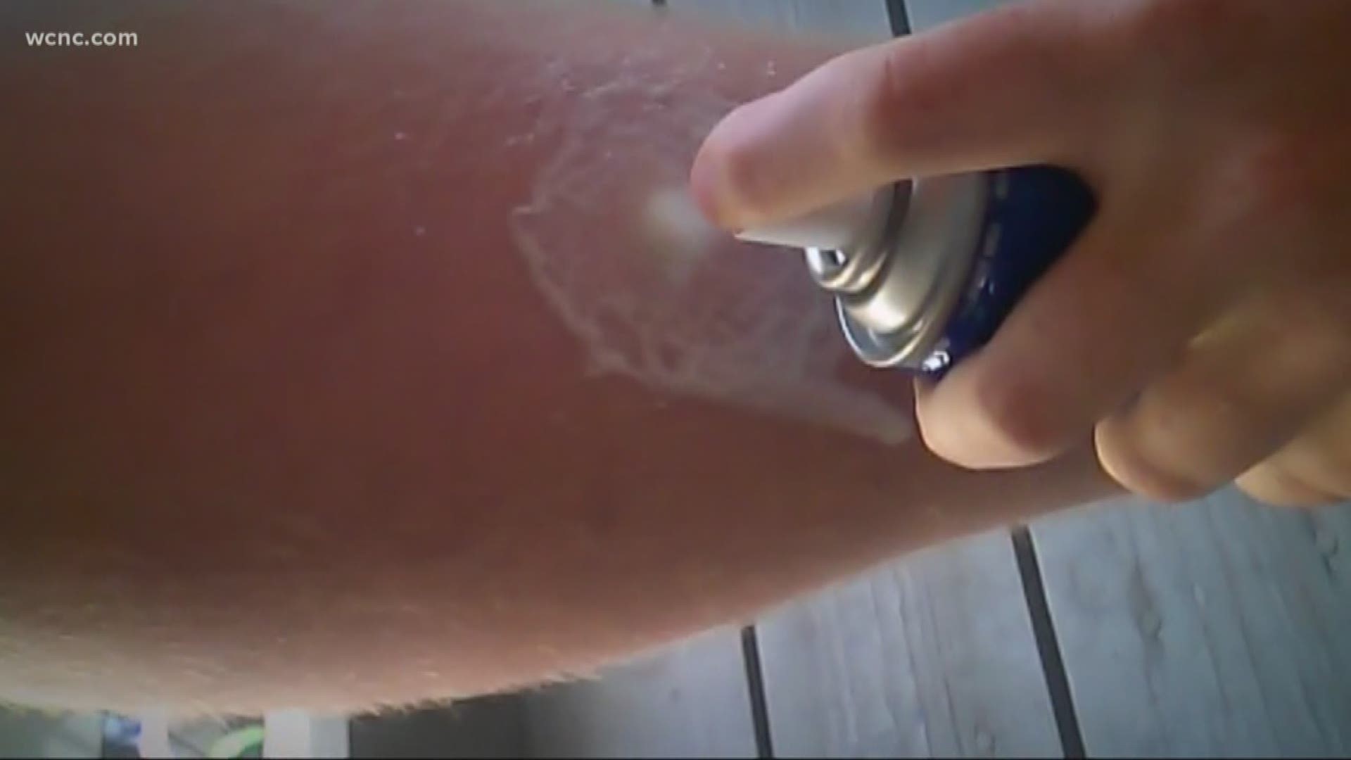 Child burned from spraying deodorant on skin