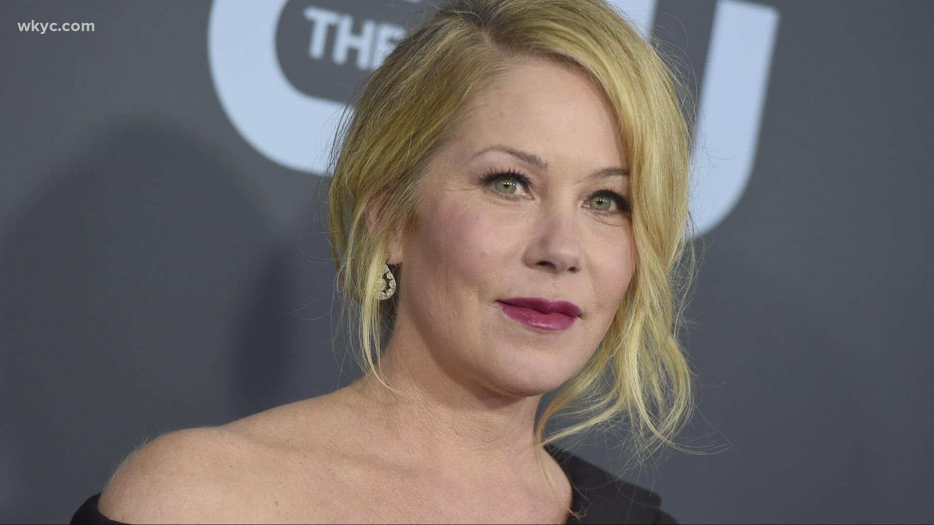 The 49-year-old actress took to twitter to reveal that she was diagnosed with the autoimmune disease a few months ago.