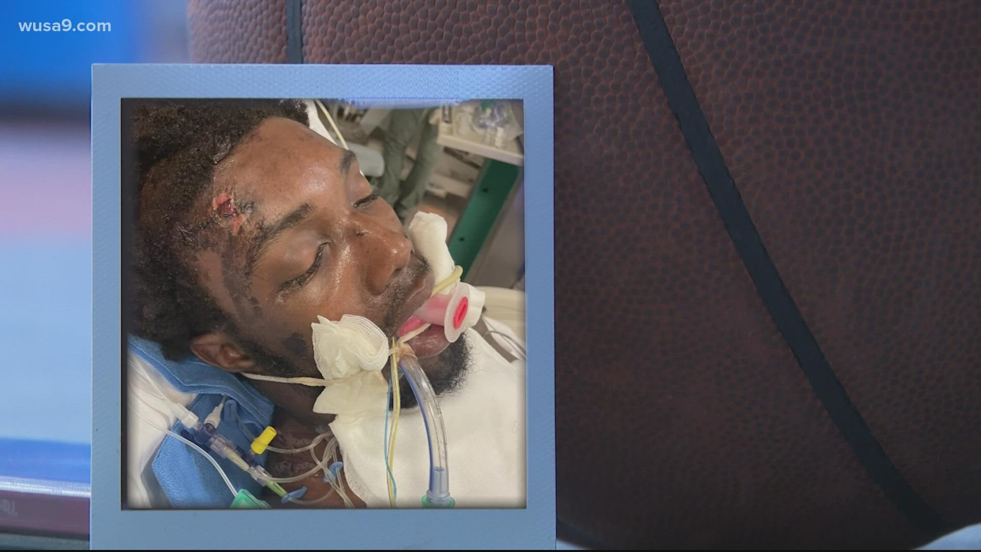 Manigault was in the Intensive Care Unit from Nov. 21 until Dec. 1. At one point, he wasn't even able to speak.