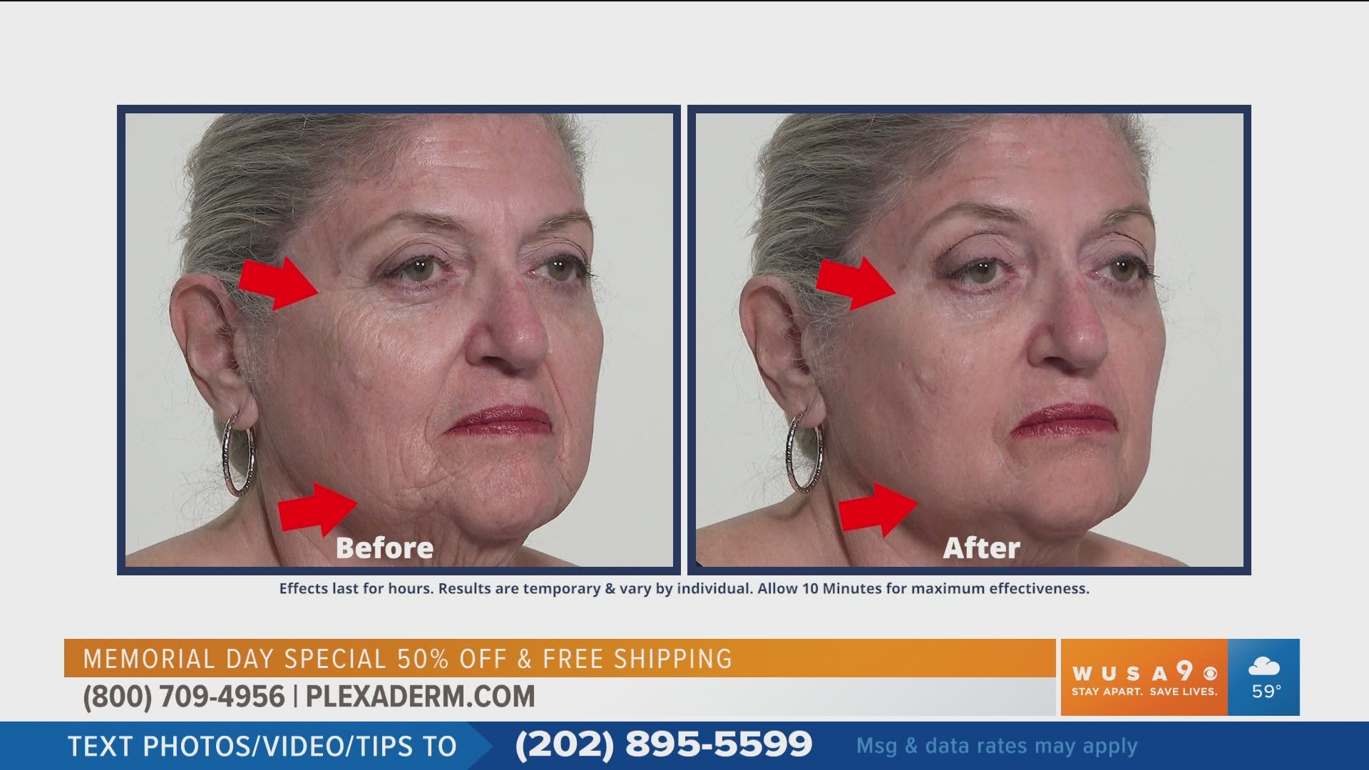 Get a firm and more youthful look with Plexaderm. The Memorial Day Special includes 50% off and free shipping! Sponsored by Plexaderm,
