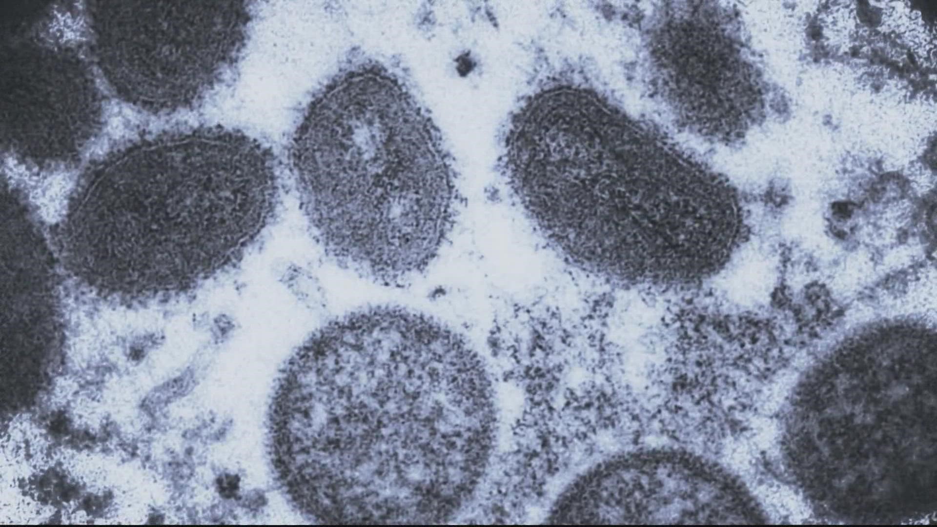 Three presumed cases of monkeypox were reported in Maryland. A case was also reported in Georgetown in D.C.