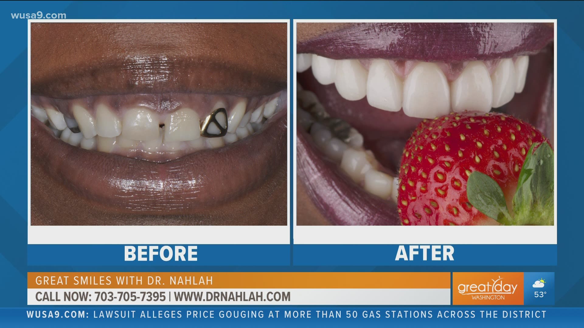 This segment is sponsored by Dr. Nahlah. See how you can get a great smile by Dr. Nahlah. Call 703-705-7295 or go to www.DrNahlah.com.