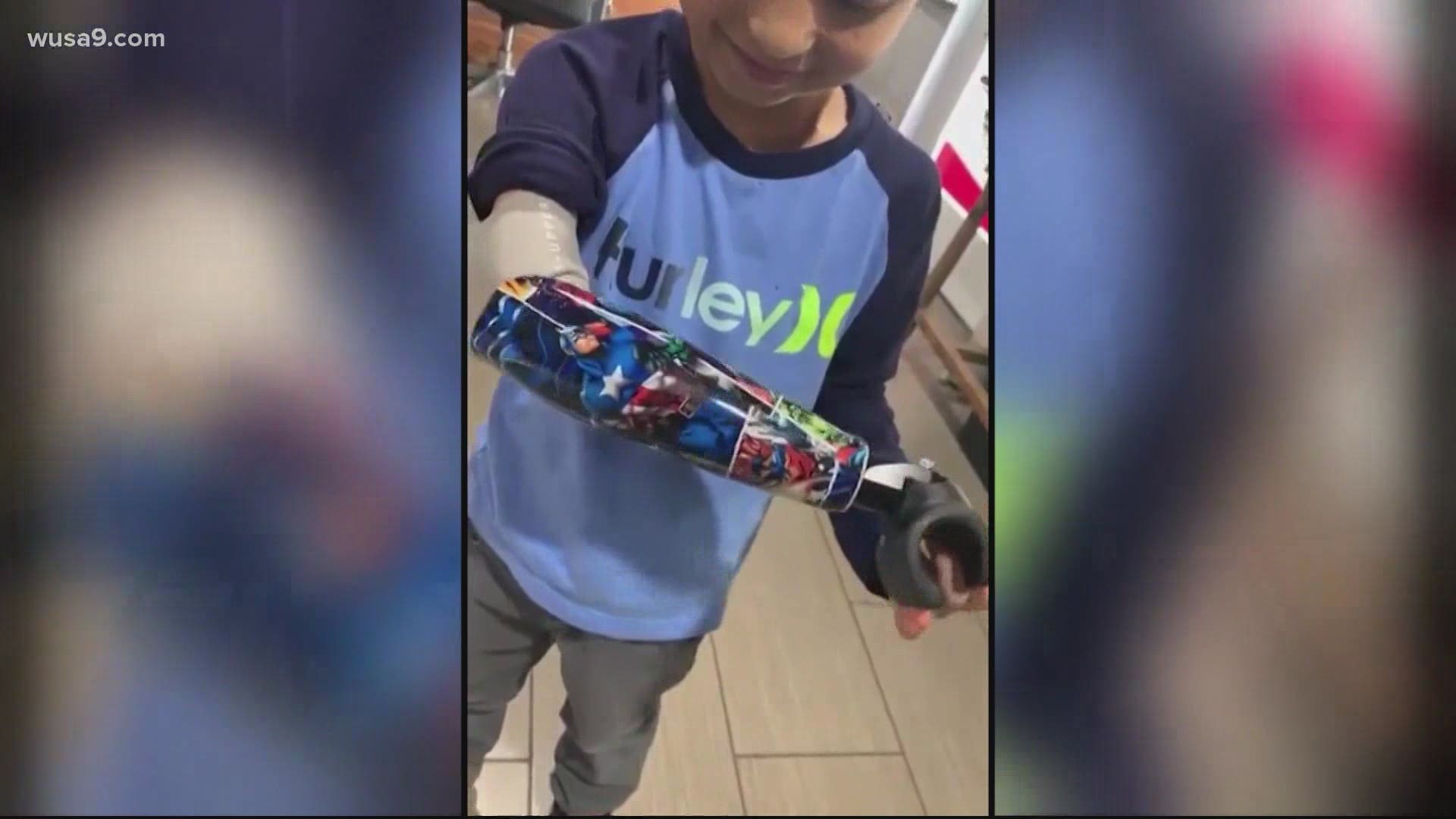 The artist paints super heroes on the prosthetic limbs and gives them away for free!
