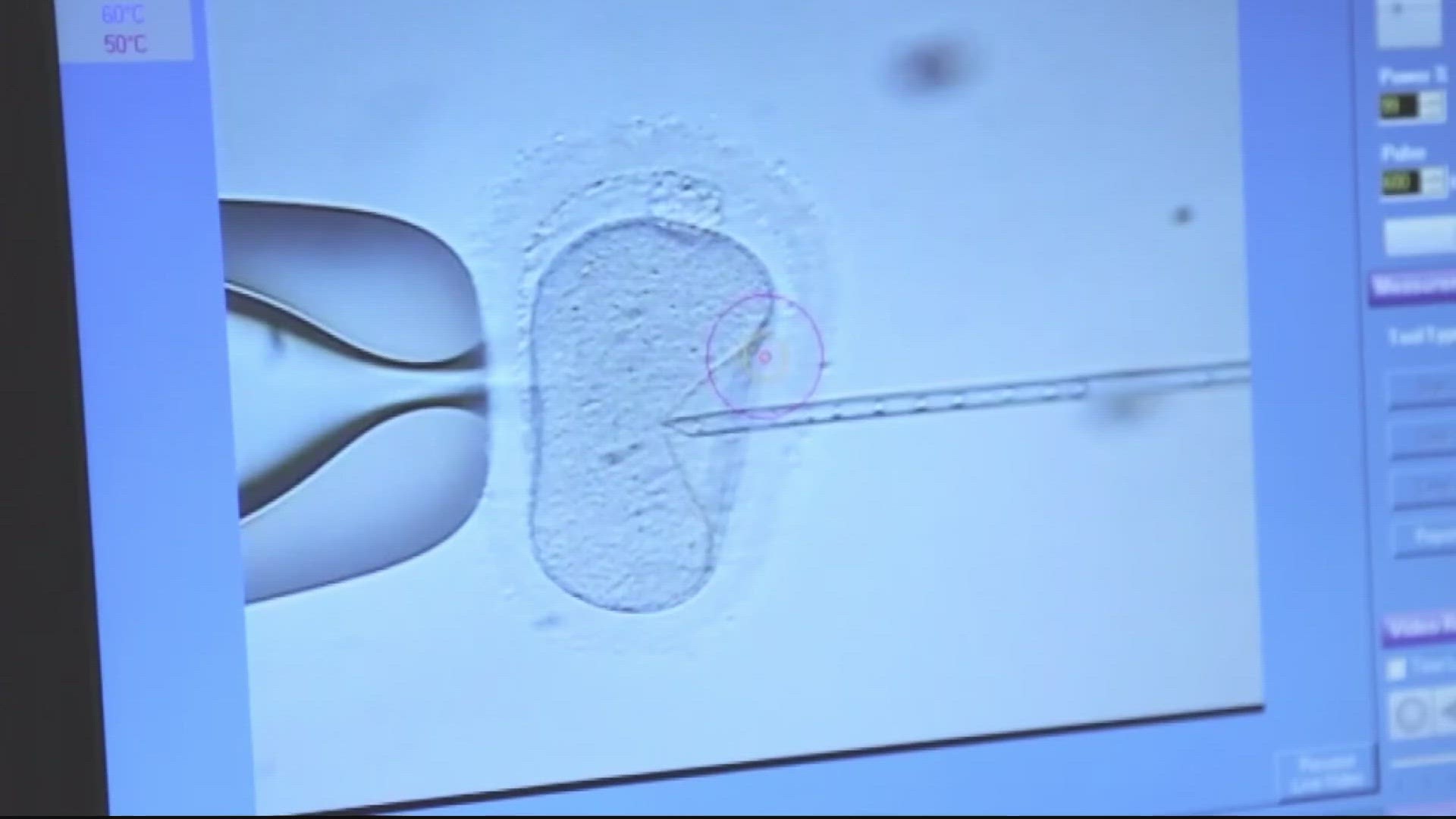 Mike Large, VP of Donor Gametes Services for California Cyrobank, discusses steps the sperm bank is taking to address the lack of diversity among donors.
