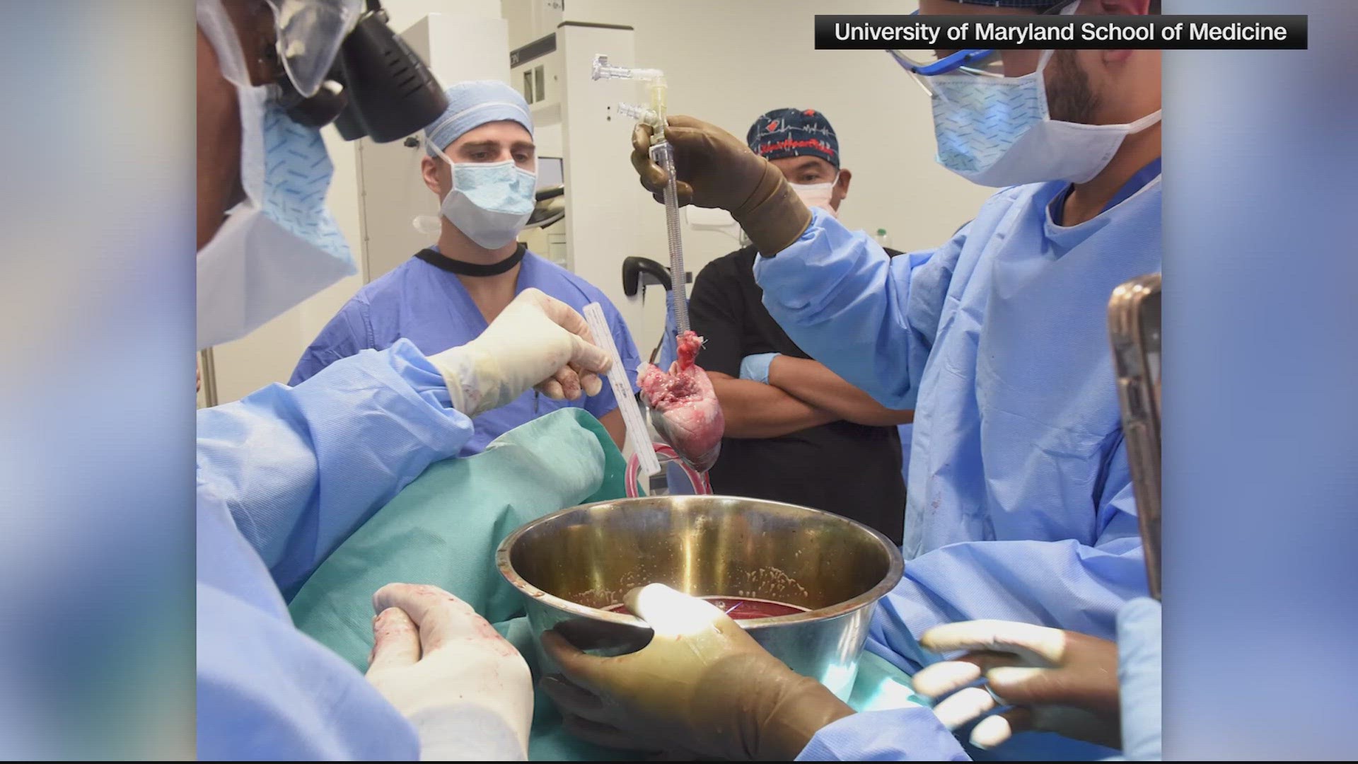 Lawrence Faucette, 58, was dying from heart failure and ineligible for a traditional heart transplant when he received the genetically modified pig heart on Sept. 20