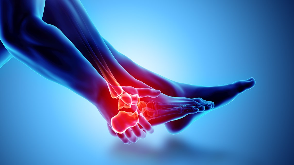 Check out how The Good Feet Store can help relieve your foot pain