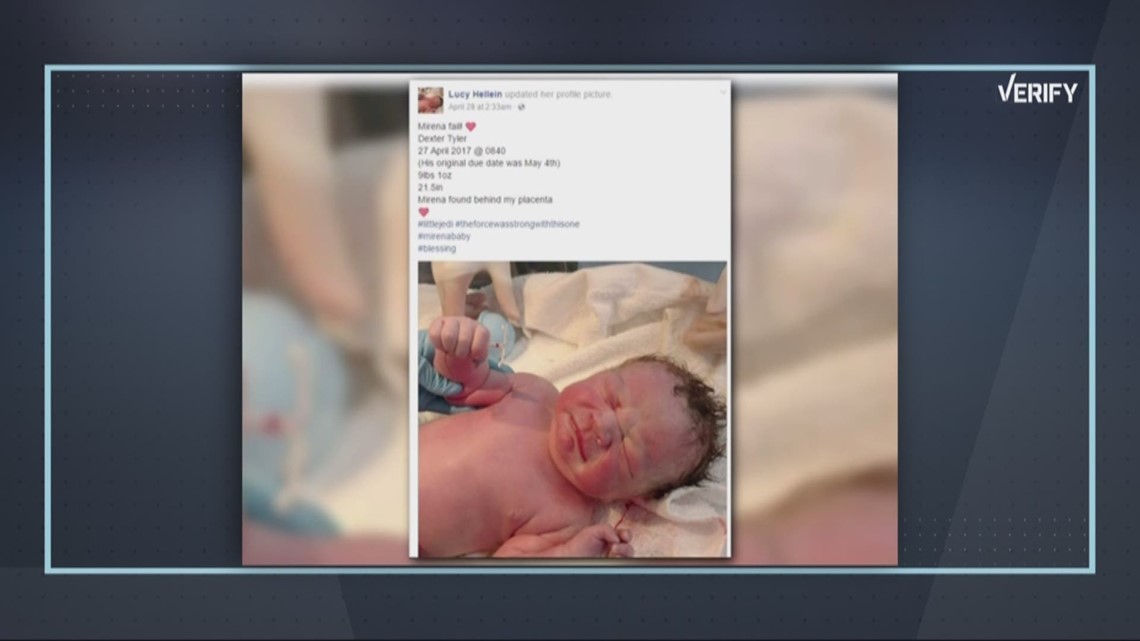 Verify Was a baby born with an IUD in its hand?