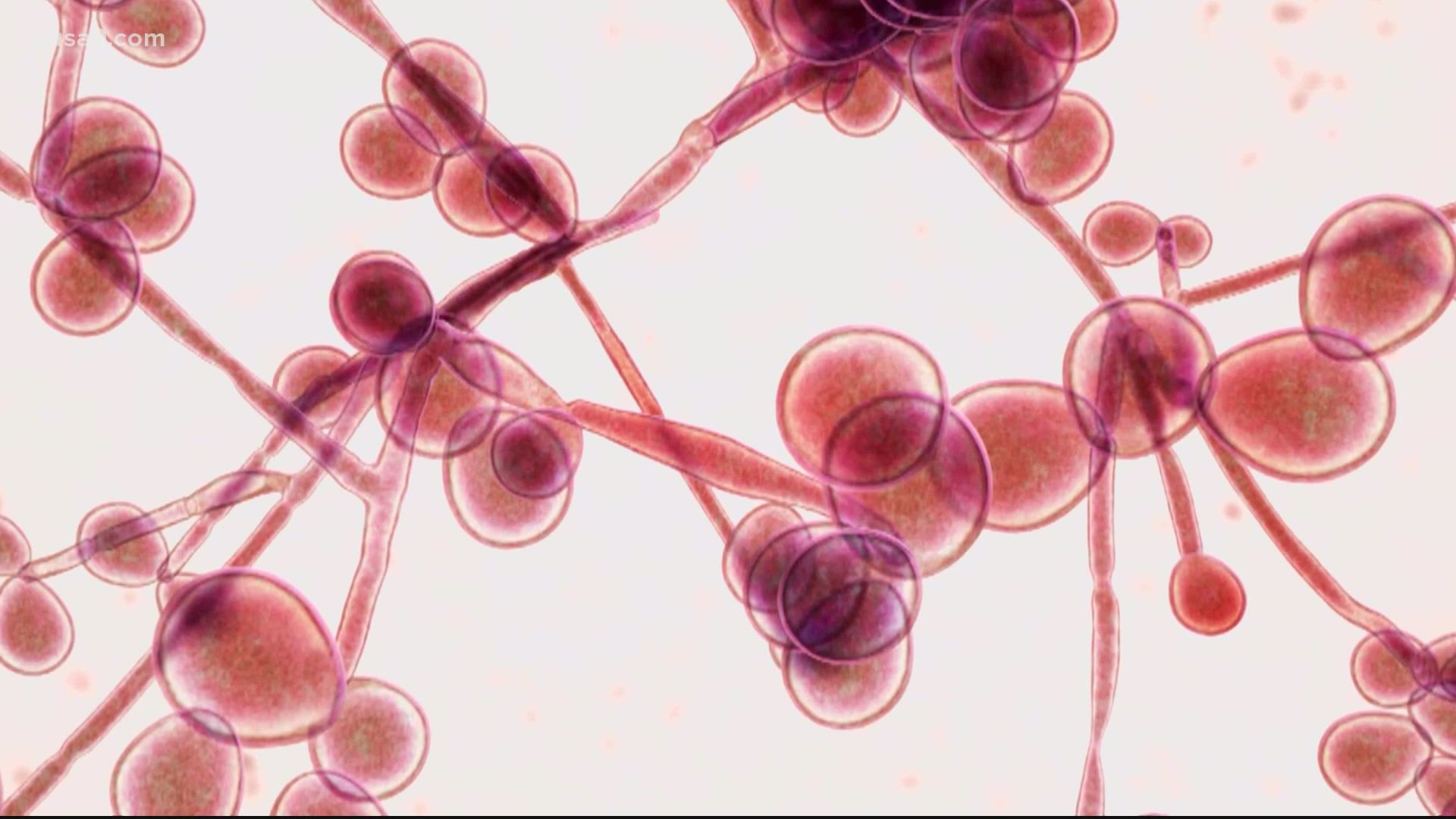 It's a fungus called "Candida Auris." The C-D-C says it infected more than 100 people at a D-C nursing home earlier this year