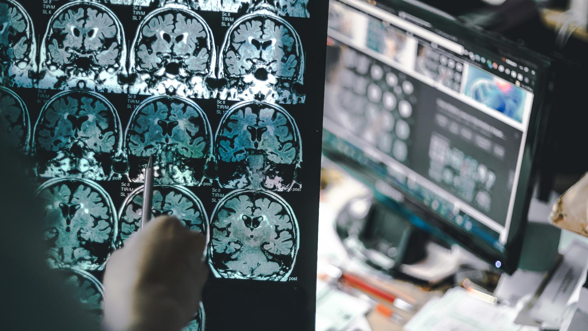 Sponsored by: Holy Cross Health. Dr. David Herzig, MD, FAANS, the Neuroscience Director at Holy Cross Health tells us what sets their program apart. 