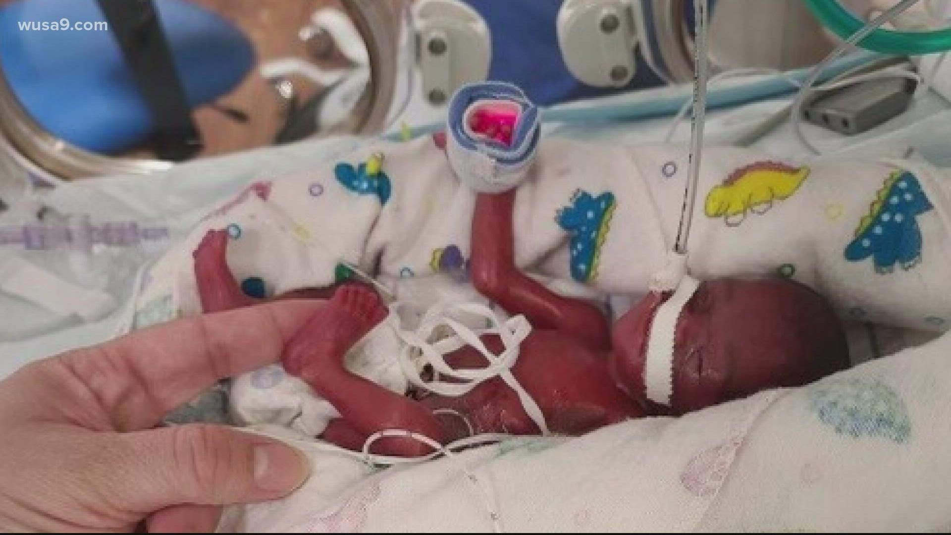 As premature baby treatment improves, Holy Cross Health sees smallest baby on record weighing only 250 grams.