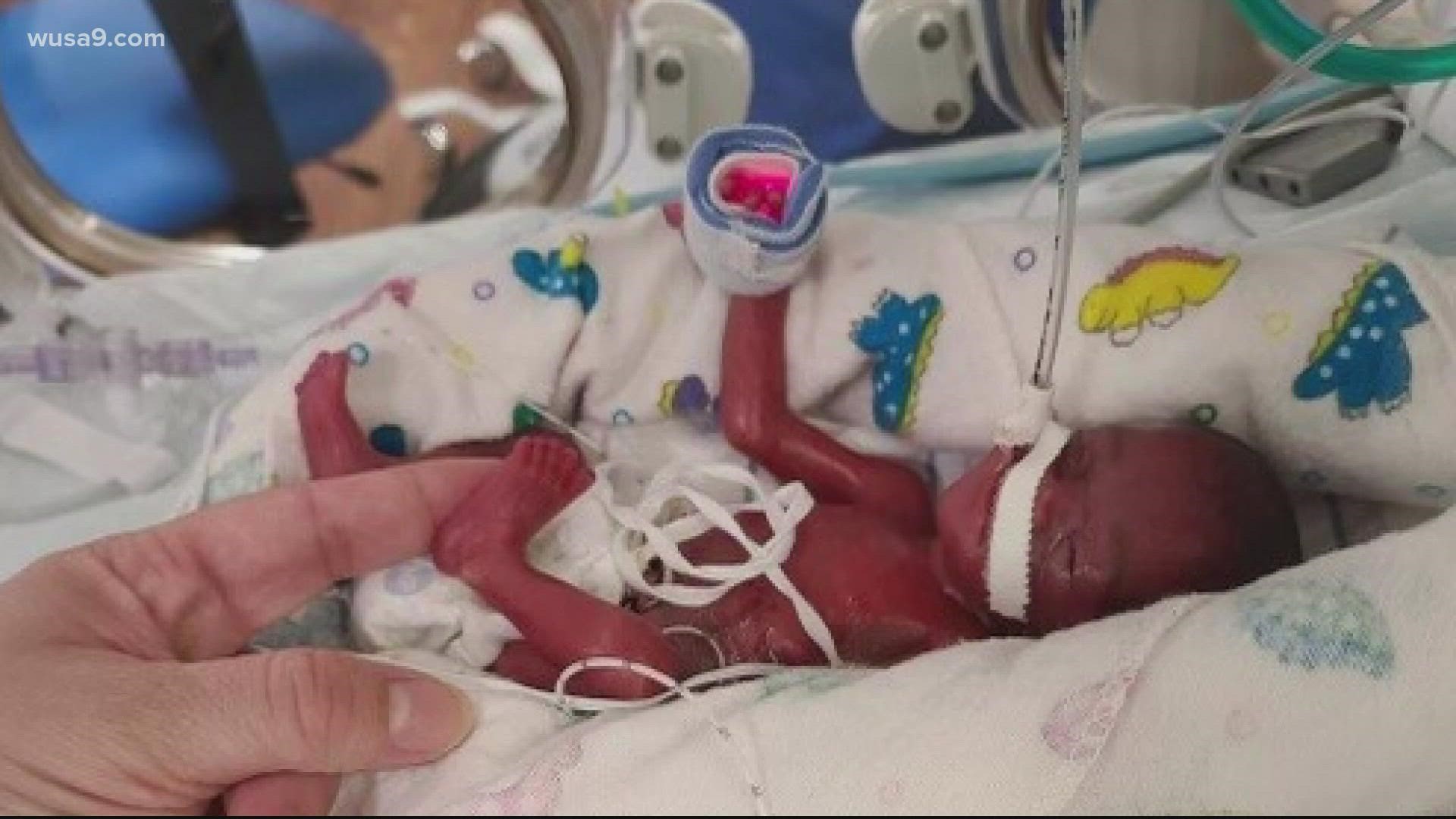 Holy Cross Health Treats Smallest Micro Baby At NICU On Record Wusa9 Holy Cross Health Treats Smallest Micro Baby At NICU On Record Wusa9
