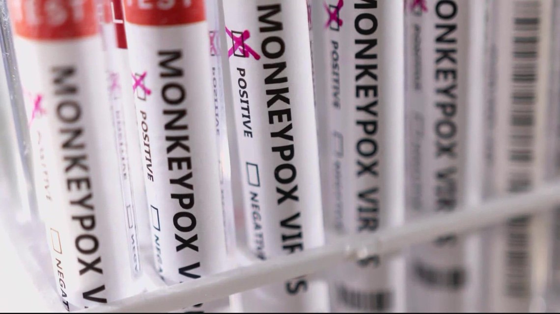 DC Health expands eligibility for monkeypox vaccine for residents