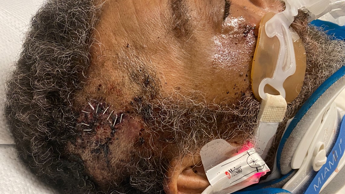 Elderly man allegedly brutally attacked at DC nursing home | wusa9 ...