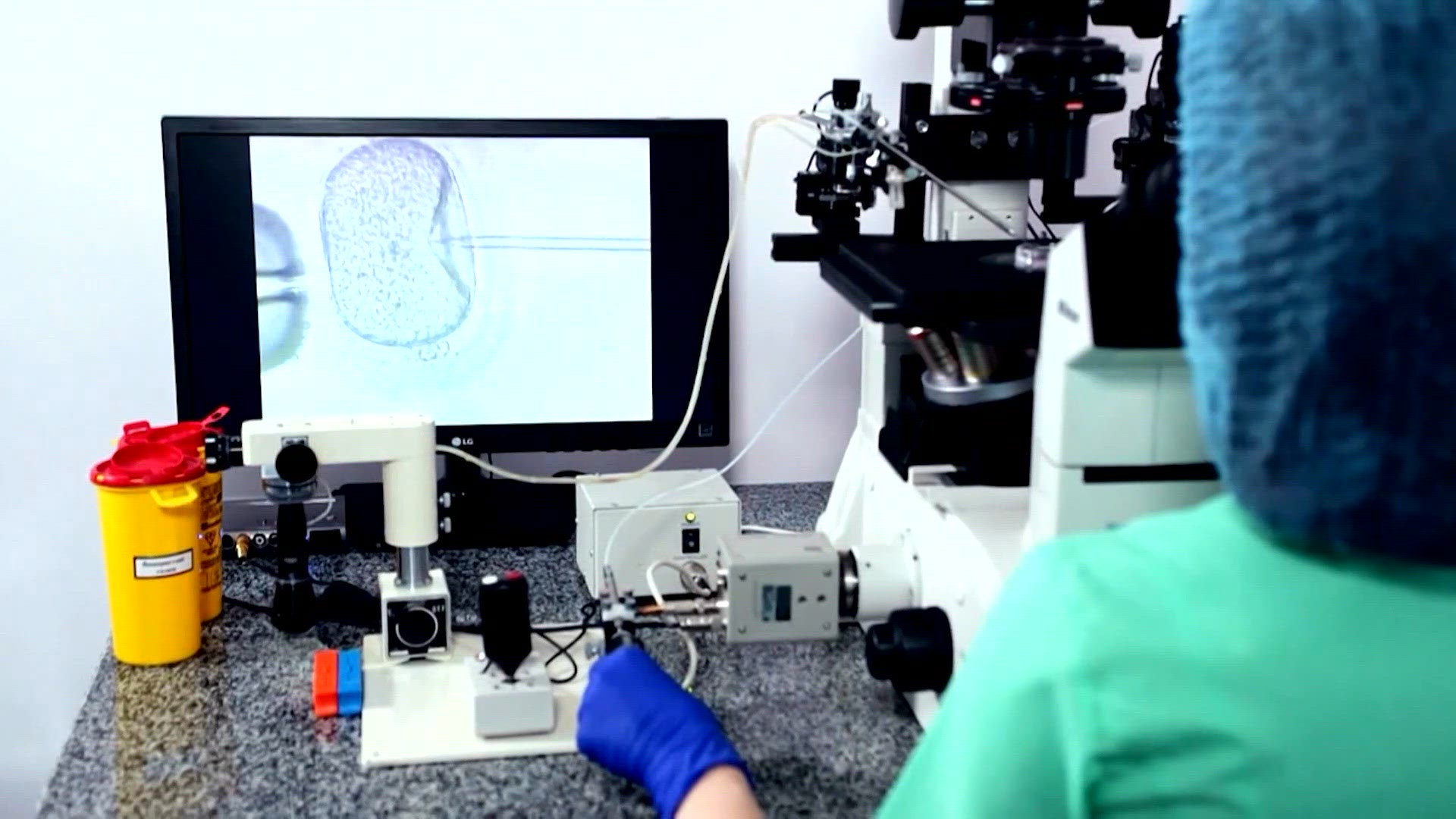 Florida couple sues IVF clinic over alleged sperm mix-up | wusa9.com