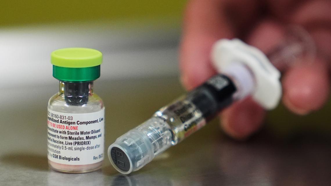 Measles case confirmed in Northern Virginia; find out where the exposure sites are believed to be