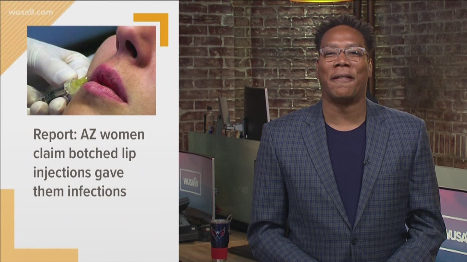 A report says that at least seven women from Arizona claim botched lip injections gave them infections. This is In Other News -- stories that may not be on your radar but should be.