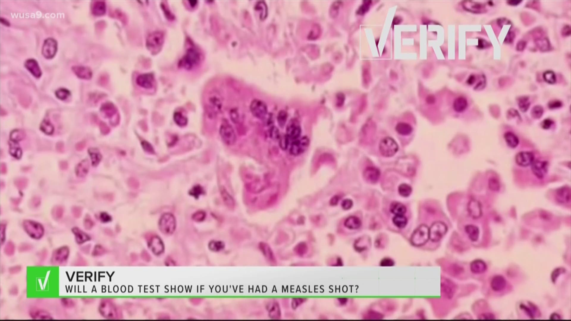 If you don't know your medical records and are worried about the measles, it turns out you can run a test to see if you ever got the shot.