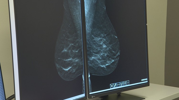 Artificial intelligence serving as 'spellcheck' for mammograms