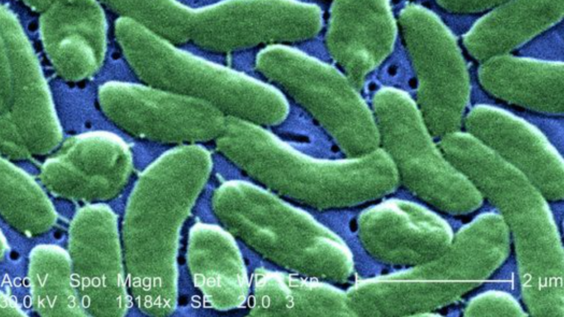 After COVID-19, 'superbugs' could be next health danger - Vimarsana News