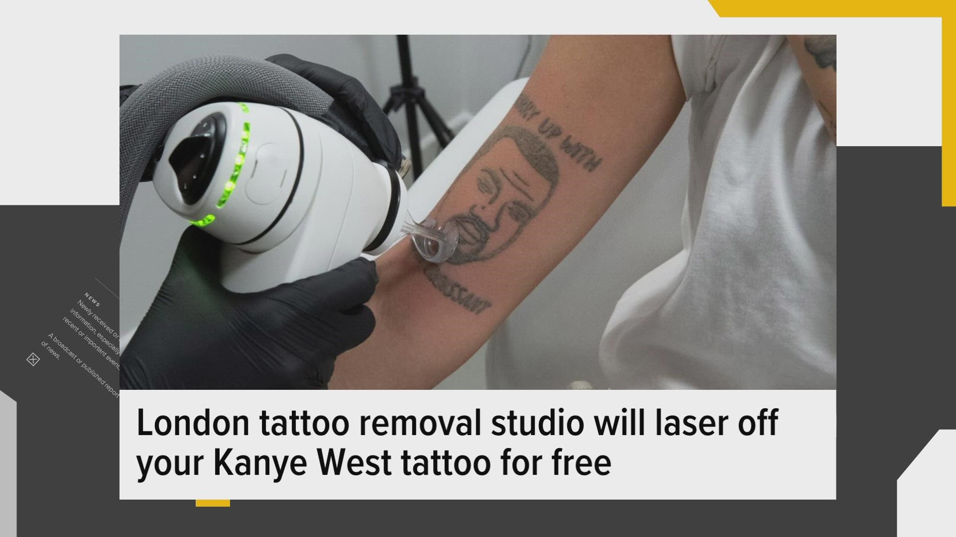 This tattoo removal studio will laser off your Kanye West tattoo for free |  CNN