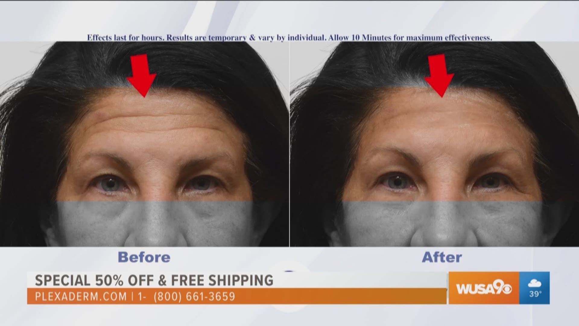 plexaderm wrinkle cream