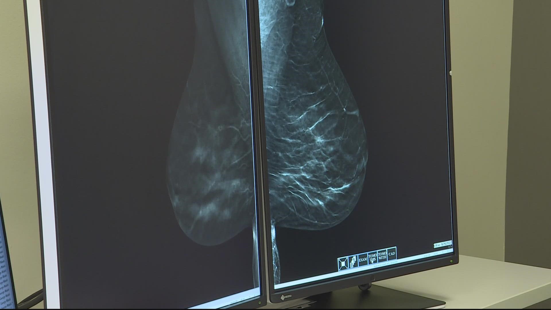 Doctors warn of false positive mammogram results after vaccine | wltx.com