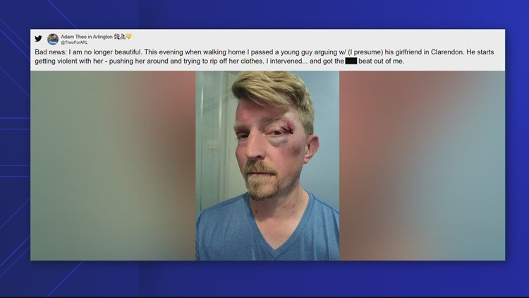 Police: Good Samaritan beaten after trying to stop man from assaulting woman