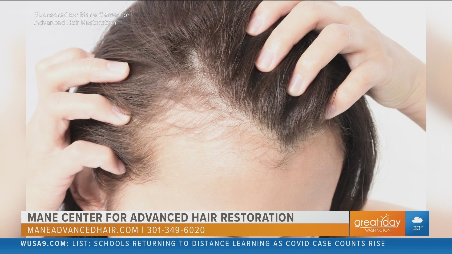 Suffering from hair loss? Get it restored | Mane Center for Advanced Hair  Restoration 