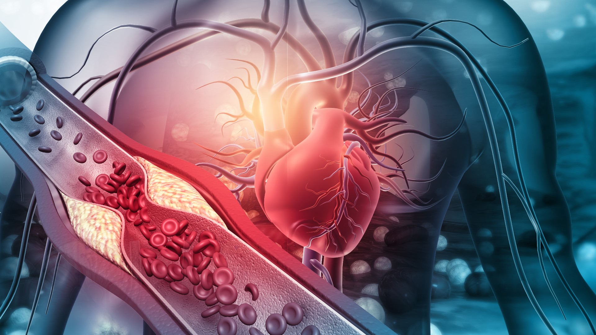 Sponsored by: Fairfax Radiology. Dr. Melany Atkins discusses how Fairfax Radiology uses Coronary CTA to detect disease. For more info go to fairfaxradiology.com.