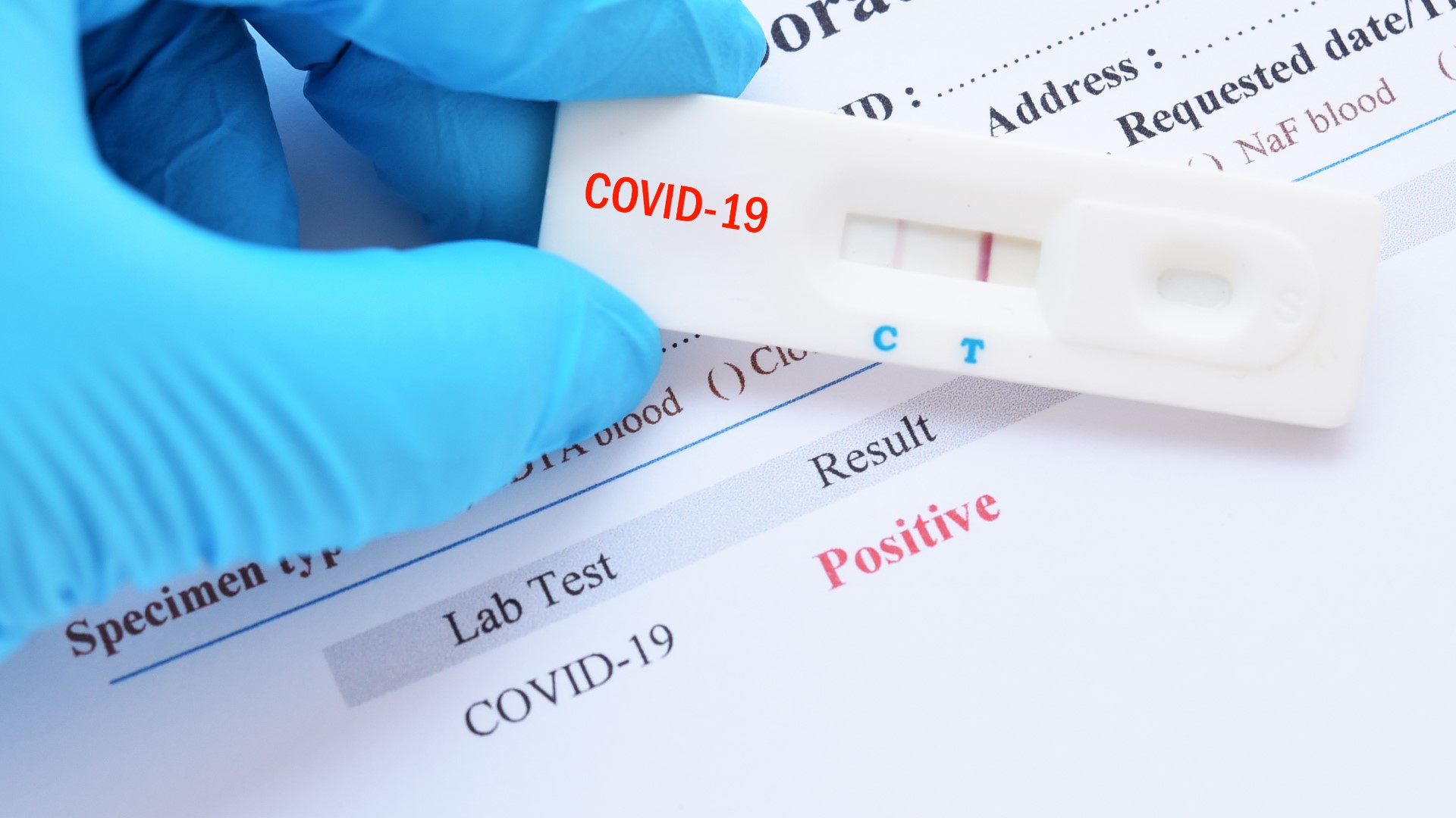 The guidance recommends a shorter quarantine period for asymptomatic COVID-19 positive patients. Instead of isolating for 10 days, isolation period is 5 days.