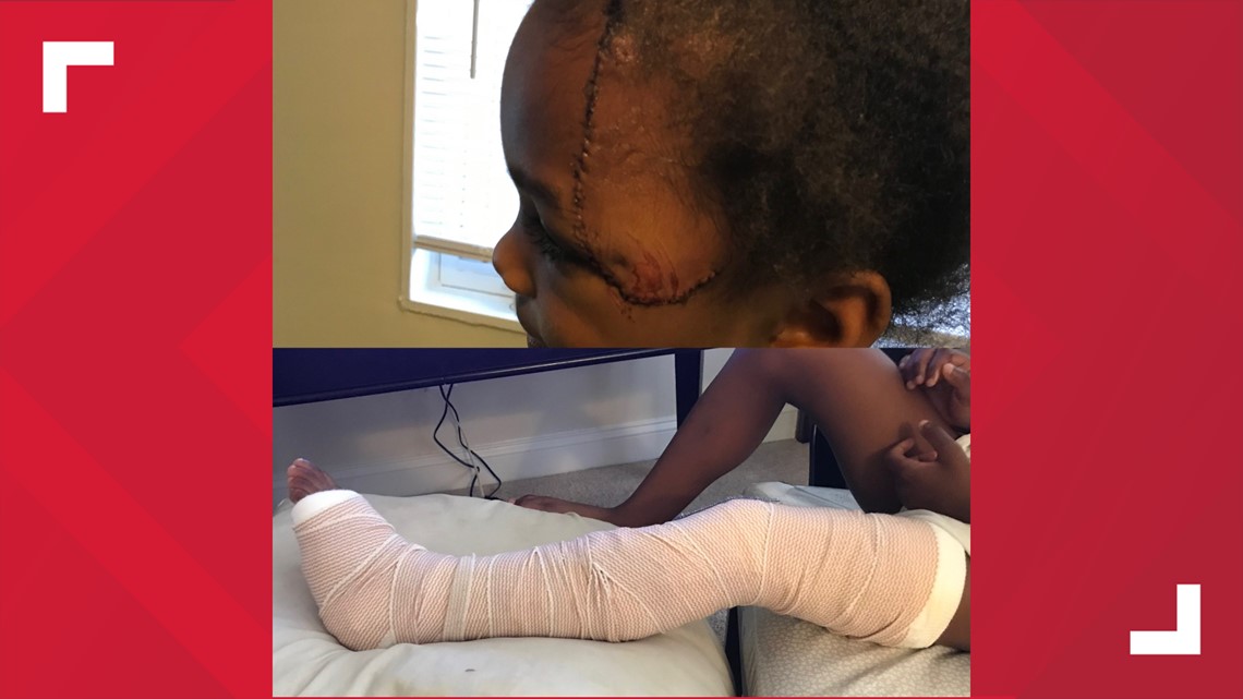 Father recounts the moment he and two daughters were hit by car - Vimarsana News