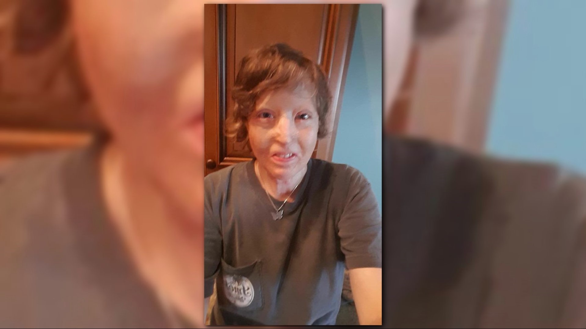 Her beautiful inside How young mom survived campfire explosion and